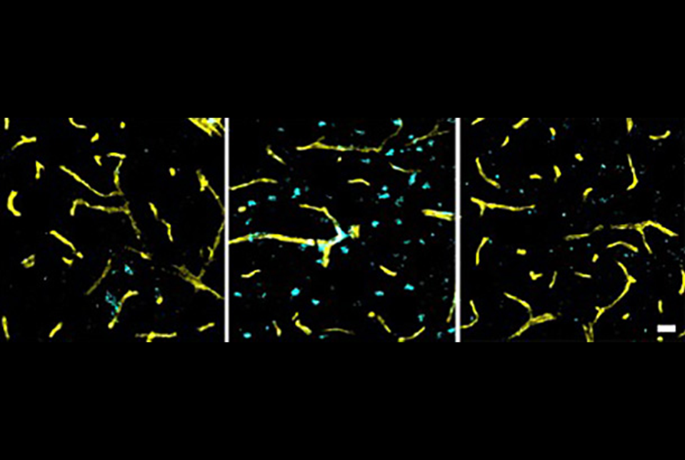 senescent neurons