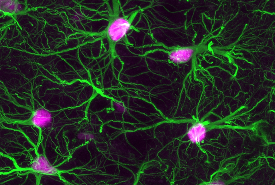 astrocytes