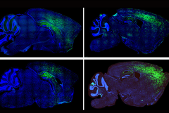 brain images with astrocytes labeled