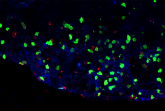 Inflammatory immune cells in the spinal cord of mouse