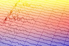 brain eeg scan